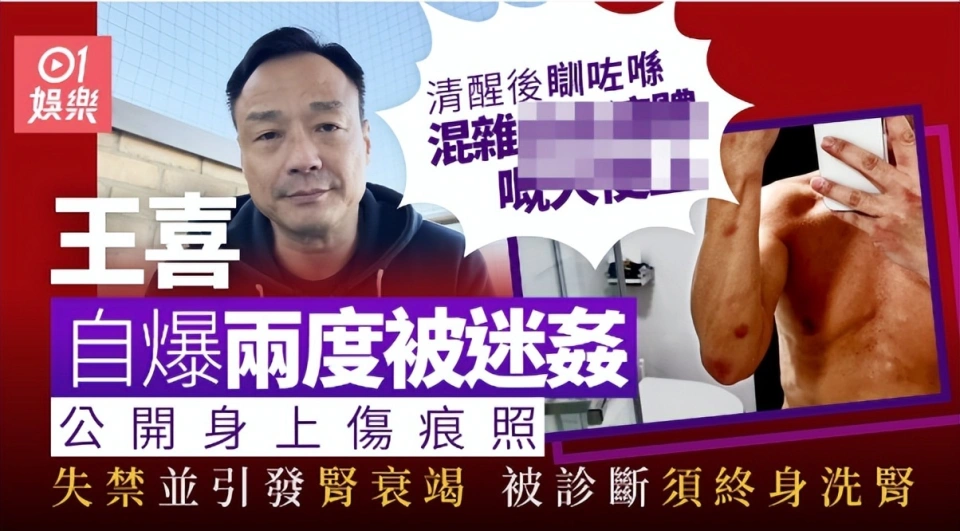 港星王喜自曝被两度侵犯后患上肾衰竭，熟人作案没报警，需终身洗肾